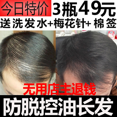 防脱发生发增发密发生发液育发液快速脂溢性产后止脱剂增长水秃顶